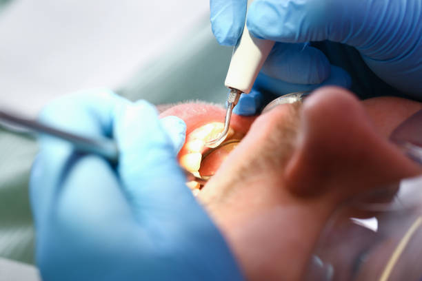 Best Pediatric Emergency Dentist in Fayette, MS